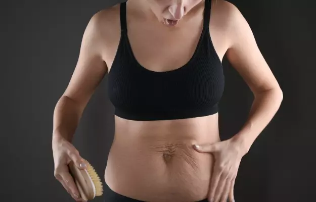 How to Get Rid of Loose Skin After Losing Weight