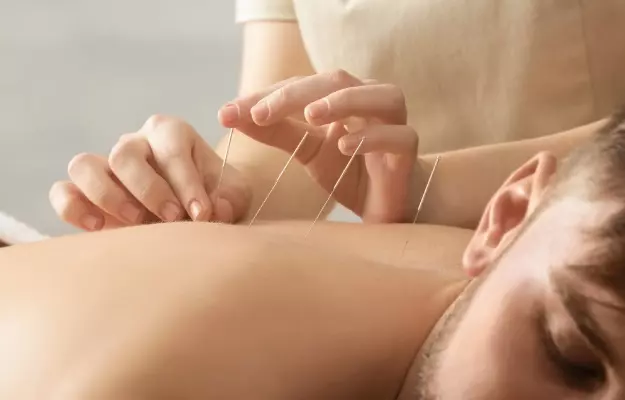 Acupuncture for Erectile Dysfunction Benefits, and Side effects