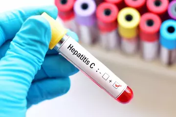 Can you get hepatitis c from sex?