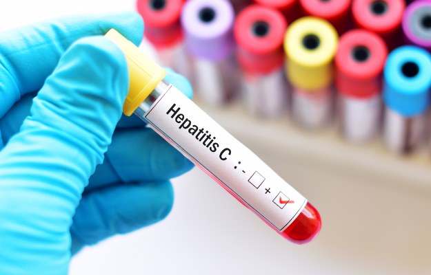 Can you get hepatitis c fro...