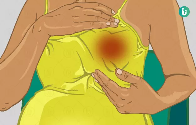 गर्भावस्था में स्तन दर्द - Breast pain in pregnancy in Hindi