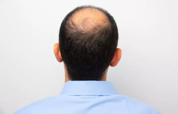 Preventing Progression: Early Intervention Strategies for Scarring Alopecia