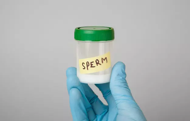 टेराटोजोस्पर्मिया - Teratozoospermia - What it is, Causes, and Treatment in Hindi