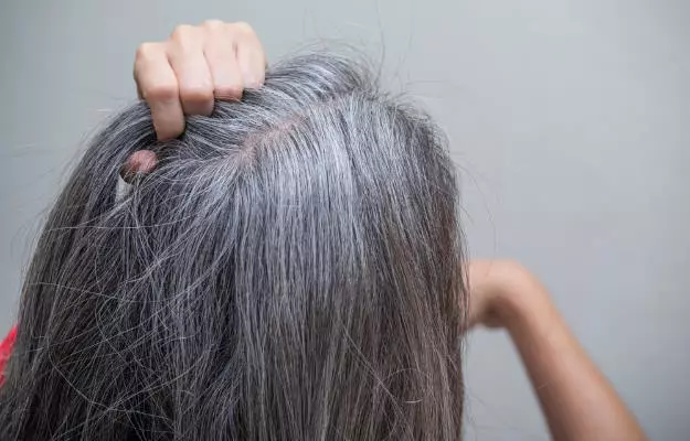 सफेद बालों को काला करने वाले टॉप 5 हेयर ऑयल - 5 Best hair oil for grey hair in Hindi