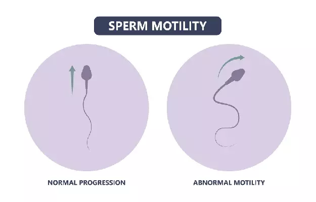स्पर्म मोटिलिटी - Sperm Motility in Hindi 