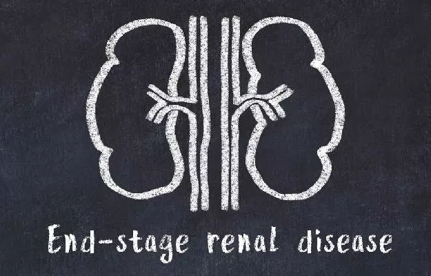 एंड-स्टेज रीनल डिसीज़ (अंतिम चरण गुर्दे की बीमारी) - End-Stage Renal Disease in hindi 