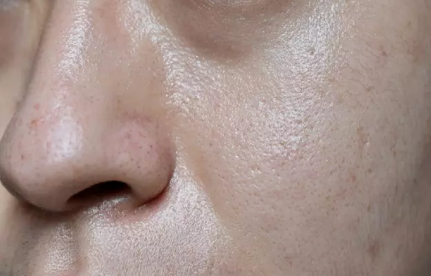 Sebum Regulation: Techniques for Maintaining Optimal Skin Oiliness