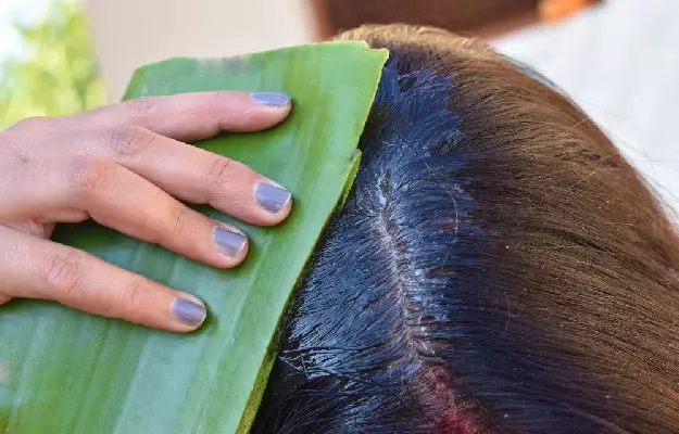 Solution to Dandruff Problem: Benefits of Aloe Vera For Dandruff