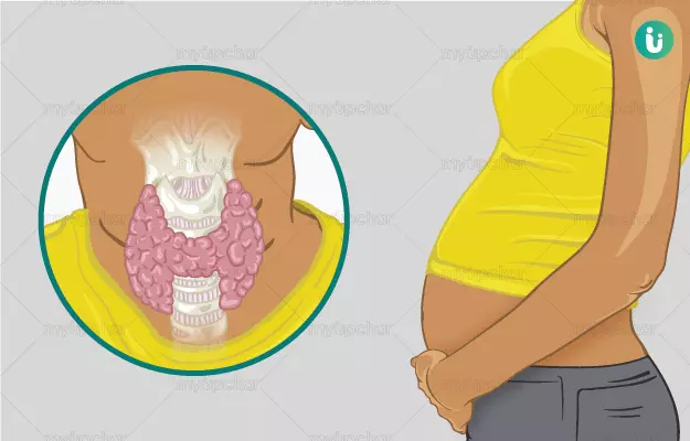 गर्भावस्था में थायराइड - Thyroid problem during pregnancy in Hindi