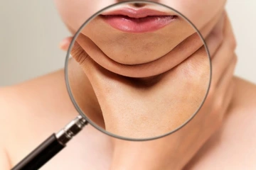 डबल चिन क्यों होती है और इसे कैसे रोकें? पूरी गाइड