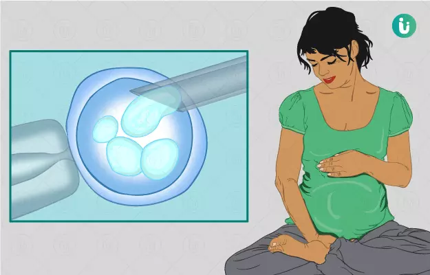 आईवीएफ - IVF (In-vitro Fertilisation) in Hindi