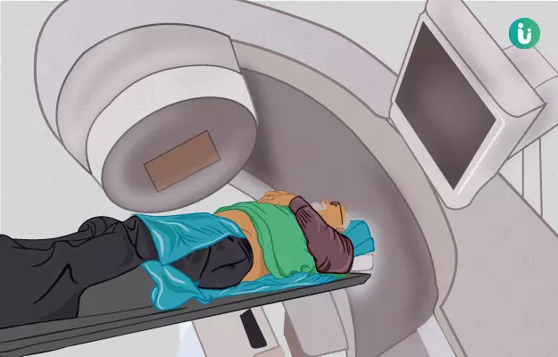 Radiotherapy or radiation therapy