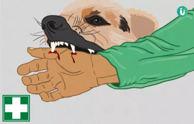 कुत्ते के काटने पर प्राथमिक उपचार - First aid for dog bite in hindi