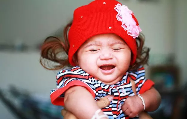 नवजात शिशु में पीलिया - Jaundice in newborn baby in Hindi