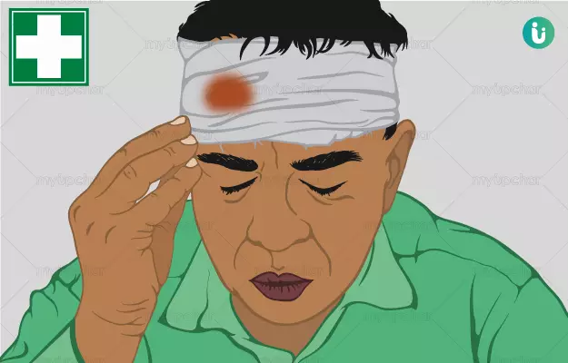 सिर पर चोट लगने पर क्या प्राथमिक उपचार करे - Sir me chot lagne par first aid in hindi
