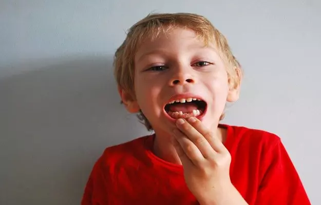 Delayed Tooth Eruption Age Causes In Infants In Adults Treatment 