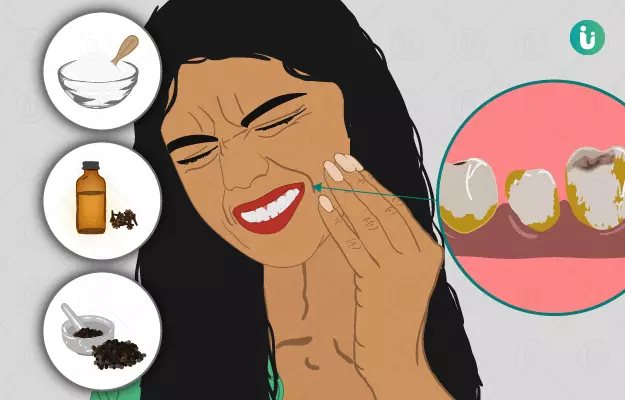 पायरिया के घरेलू उपाय - Home remedies for periodontitis in Hindi