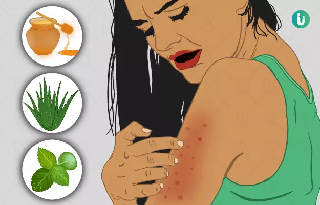 स्किन एलर्जी के घरेलू उपाय व नुस्खे - Home remedies for skin allergy in Hindi