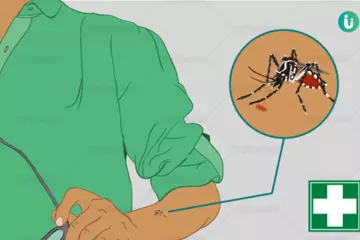 How to Provide Immediate Care for Dengue Patients