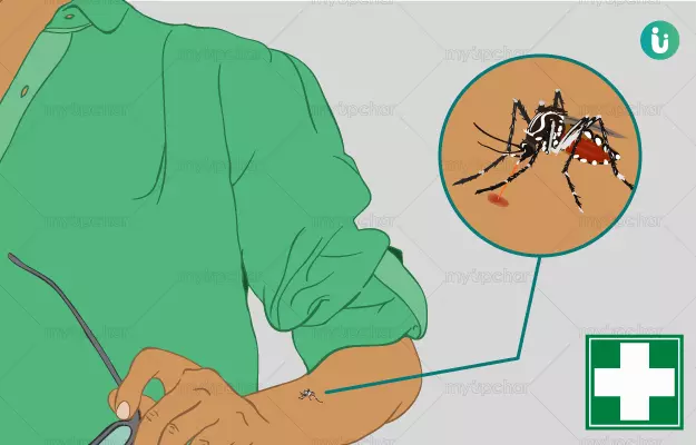 डेंगू हो जाये तो क्या प्राथमिक उपचार करें - Dengue me kya karna chahiye in hindi