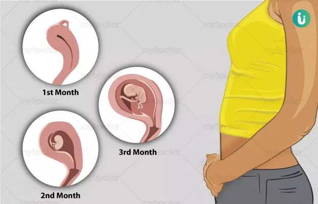 गर्भावस्था की पहली तिमाही -  first trimester pregnancy in Hindi