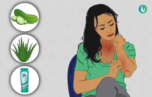 घमौरियों से बचने ठीक करने का तरीका उपाय - Home remedies for heat rashes in Hindi
