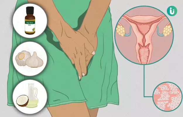 योनीमधील यीस्ट संक्रमणासाठी घरगुती उपाय - Home Remedies for Vaginal Yeast Infection in Marathi