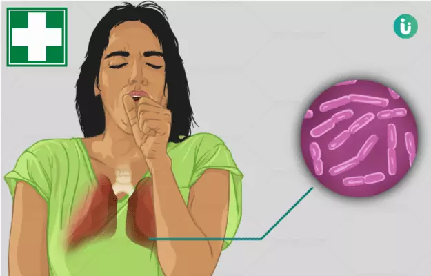 टीबी के लिए क्या करना चाहिए - TB ho jaye to kya kare in hindi