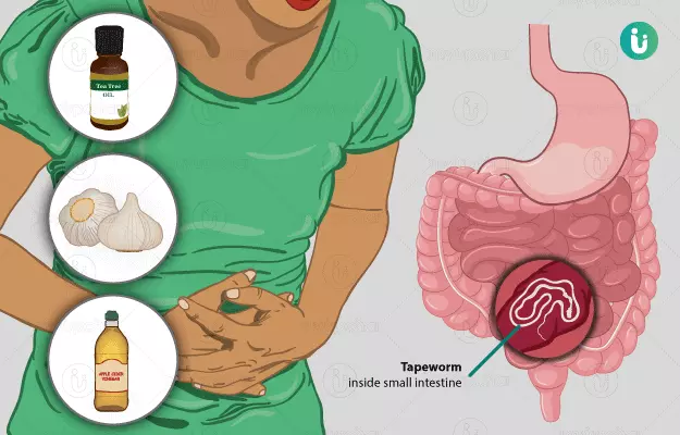 पेट में कीड़े मारने के घरेलू उपाय और नुस्खे - Home remedies for intestinal worms in hindi 