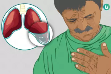 Common Causes of Chest Tightness and How to Manage Them Effectively