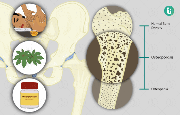 Ayurvedic Treatment Medicines Remedies Herbs for Osteoporosis