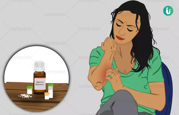 Homeopathic medicine, treatment and remedies for Itching