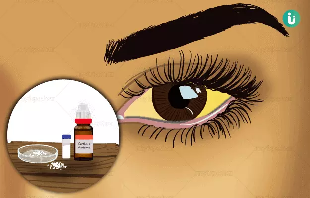 Homeopathic medicine, treatment and remedies for Jaundice