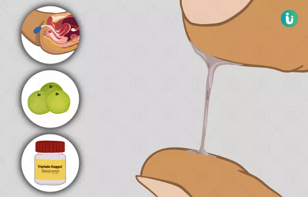 ल्यूकोरिया (सफेद पानी आने) की आयुर्वेदिक उपाय - Ayurvedic remedy for leucorrhoea in Hindi