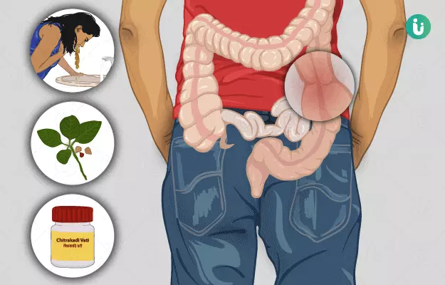 Ayurvedic medicine, treatment and remedies for Irritable Bowel Syndrome
