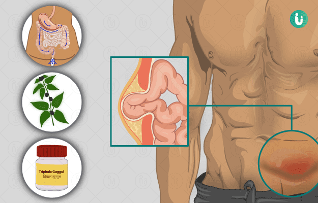 Ayurvedic Treatment, Medicines, Remedies, Herbs for Hernia: Types,  Effectiveness, and Risks