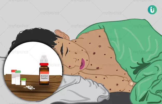 Homeopathic medicine, treatment and remedies for Chickenpox