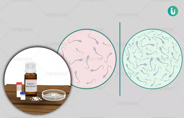 Homeopathic medicine, treatment and remedies for Low Sperm Count