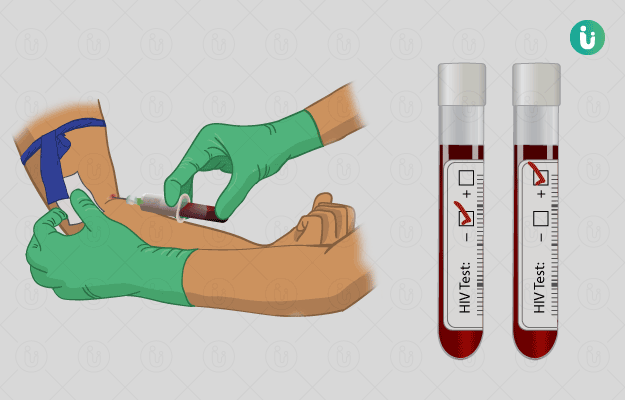 HIV Test: Procedure, Purpose, Results, Cost, Price, Online booking