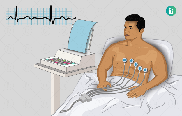 ecg-normal-range-normal