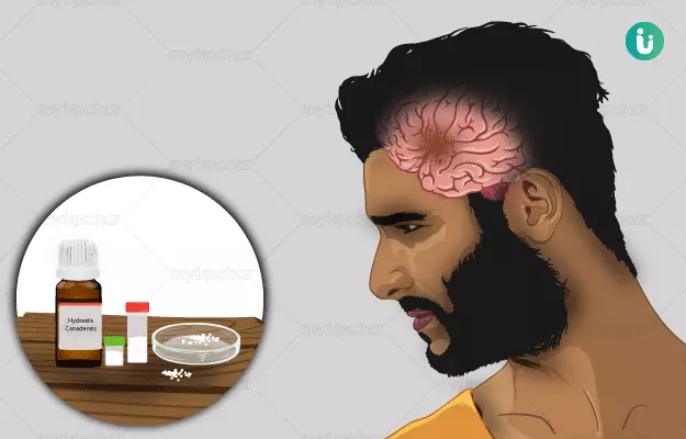 Homeopathic medicine, treatment and remedies for Brain Tumour