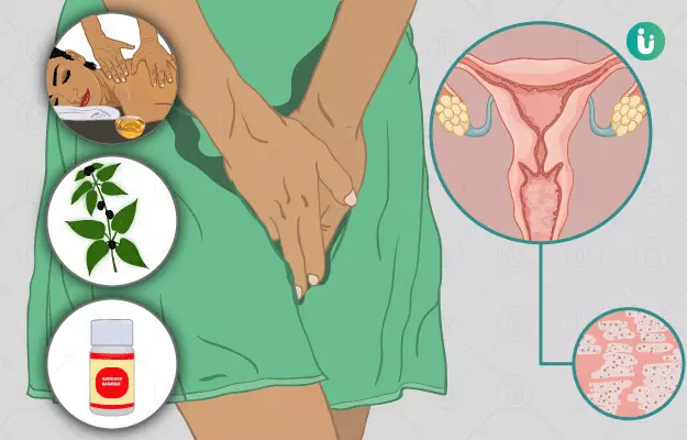 Ayurvedic medicine, treatment and remedies for Vaginal Yeast Infection
