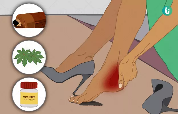 Ayurvedic medicine, treatment and remedies for Heel Pain