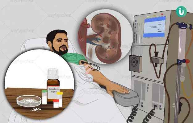 किडनी फेल होने की होम्योपैथिक दवा और इलाज - Homeopathic medicine and treatment for Chronic Kidney Disease in Hindi