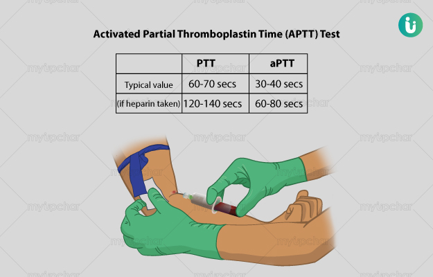 APTT (Activated Partial Thromboplastin Time) Procedure, Purpose, Results, values, Price, Online booking