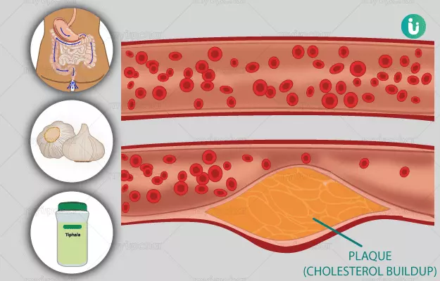 Ayurvedic medicine, treatment and remedies for High Cholesterol