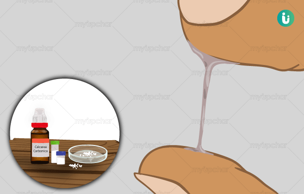 Homeopathic Treatment, Medicines, Remedies for Leucorrhea: Types,  Effectiveness, and Risks
