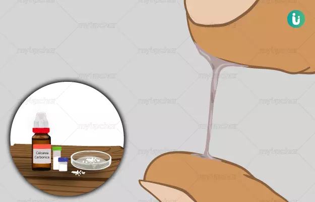 Homeopathic medicine, treatment and remedies for Leucorrhea