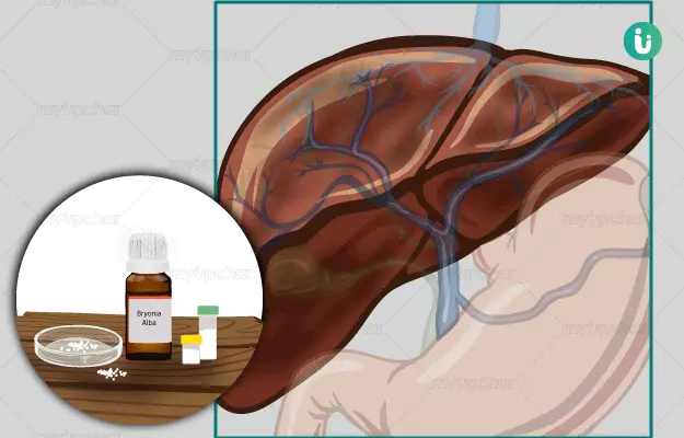 Homeopathic medicine, treatment and remedies for Liver disease