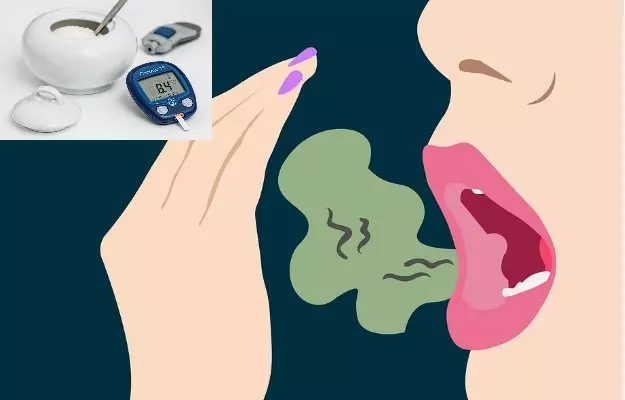 जानिये मुँह की बदबू का डायबिटीज से क्या है सम्बन्ध - Link between bad breath and diabetes in Hindi